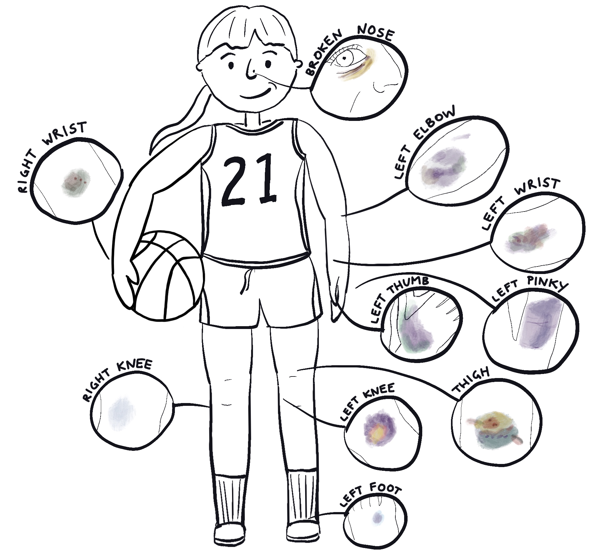 An illustrated list of basketball bruises